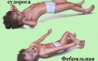 Фебрильные судороги у детей — что это такое, как лечить?