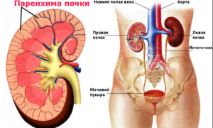 Что такое диффузное изменение почек, чем оно грозит