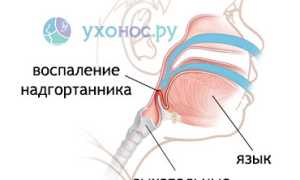 Гемофильная инфекция: возбудитель, клиника, как лечить, вакцинация