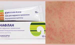Мазь Синафлан