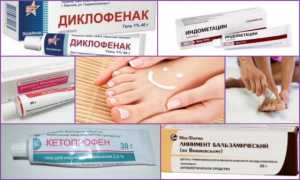Выбираем лучшую мазь от подагры на ногах