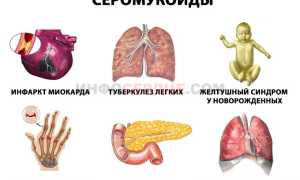 Что такое серомукоиды и для чего они нужны в крови?