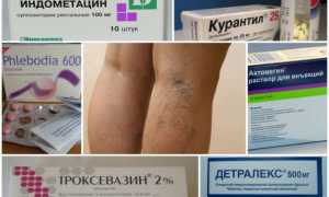 Медицинские препараты от варикоза