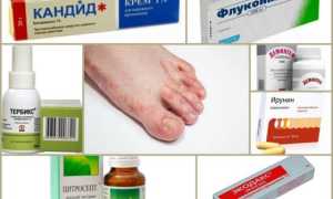Недорогие, но эффективные препараты для лечения грибка стопы