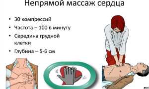 Как правильно делать непрямой массаж сердца?