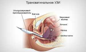 Что видно на УЗИ в 10 недель беременности и стоит ли его делать: норма и отклонения