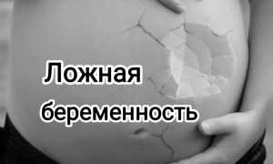 Ложная беременность — симптомы