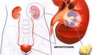 От чего появляется моча с кровью при беременности – причины и лечение