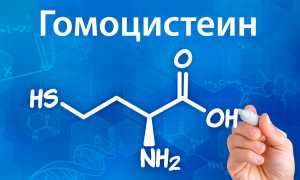 Гомоцистеин при беременности — что это такое