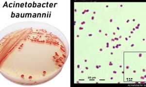 Acinetobacter: характеристика, патогенность, симптоматика, диагностика, лечение
