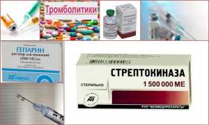Что такое тромболитики — обзор самых эффективных препаратов