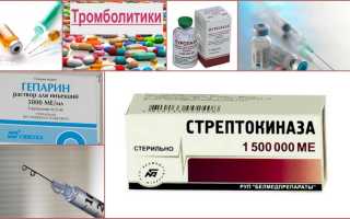Что такое тромболитики — обзор самых эффективных препаратов