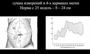 Индекс амниотической жидкости — норма по неделям