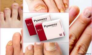 Полная инструкция по применению Румикоза при грибке ногтей