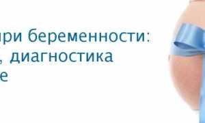 Диарея у беременных: причины, симптомы, методы лечения