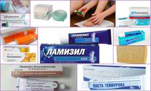 Обзор мазей от запаха ног и повышенной потливости