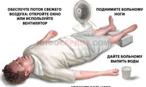 Все про геморрагический инсульт головного мозга