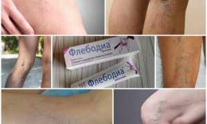 Крем-гель для ног Флебодиа