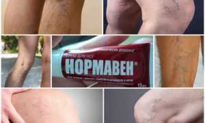 Крем для ног Нормавен