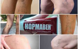 Крем для ног Нормавен