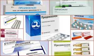 Лекарства при ревматизме суставов — обзор препаратов