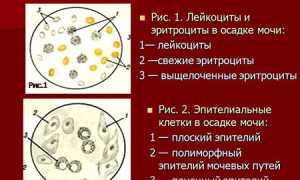 Какие анализы мочи существуют – виды исследований, нормы