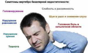 Что означает диагноз — вертебро-базилярная недостаточность (ВБН)?