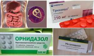 Лечение лямблиоза при беременности: методы и особенности терапии
