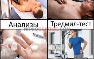 Почему возникает кардионевроз и как от него избавиться?