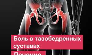 Почему болит тазобедренный сустав?  Что делать, чем и как  лечить?