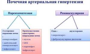 Виды почечной гипертензии: причины и лечение заболевания