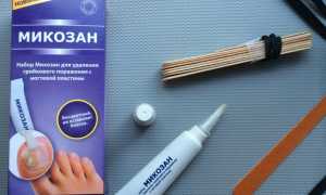 Микозан от грибка ногтей: отзывы, цена, аналоги