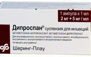Применение Дипроспана