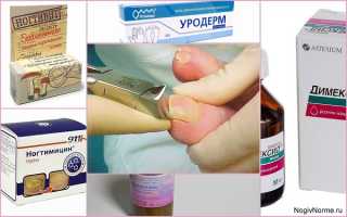 Чем и как размягчить грибковые ногти на ногах в домашних условиях?