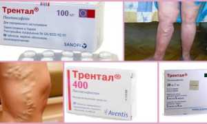 Ампулы и таблетки Трентал