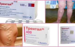 Ампулы и таблетки Трентал