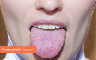 Воспаление сосочков на корне и кончике языка, причины увеличения (гипертрофии)
