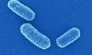 Klebsiella spp в моче – что это значит?