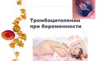 Тромбоцитопения при беременности