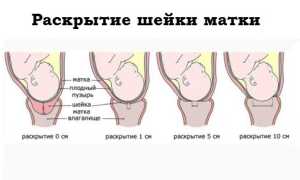 Какие изменения происходят в шейке матки перед родами
