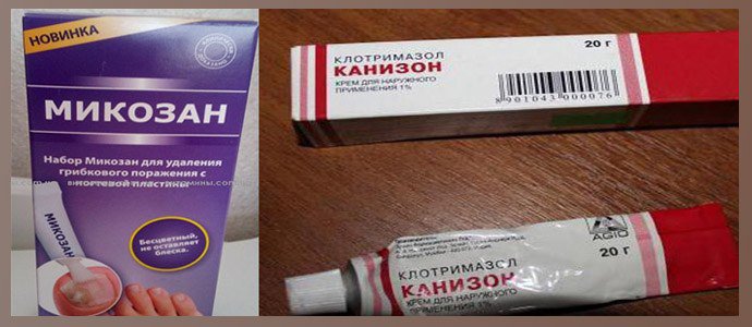 Микозан, Канизон