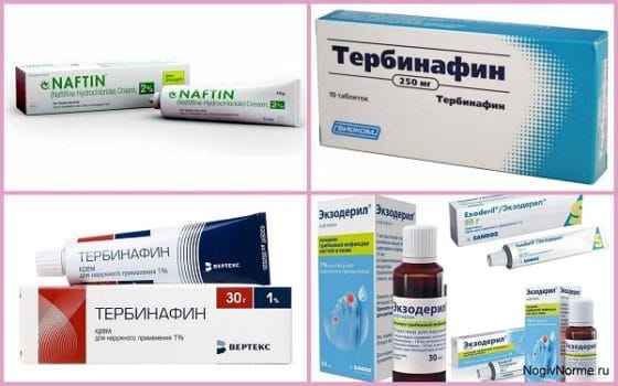 Аллиламины для лечения грибковых дерматомикозов