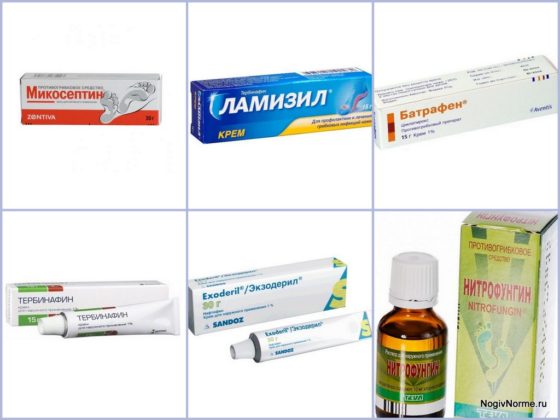 Аналоги препарата Вартнер