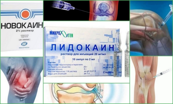Анестетики для проведения блокады коленного сустава