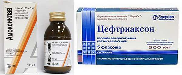 антибиотикотерапия