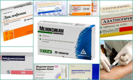 Болезнь Стилла – основные методы лечения