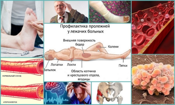 Болезни, которые приводят к онемению