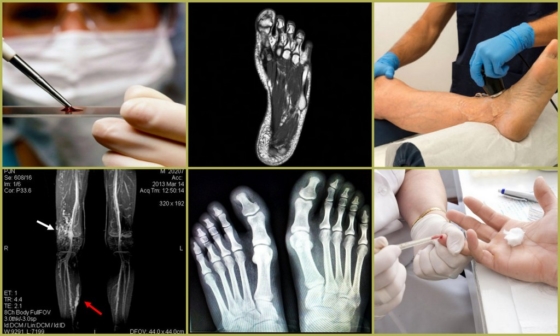 Диагностика причин судорог пальцев