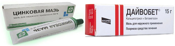 еффективные негормональные мази при псориазе