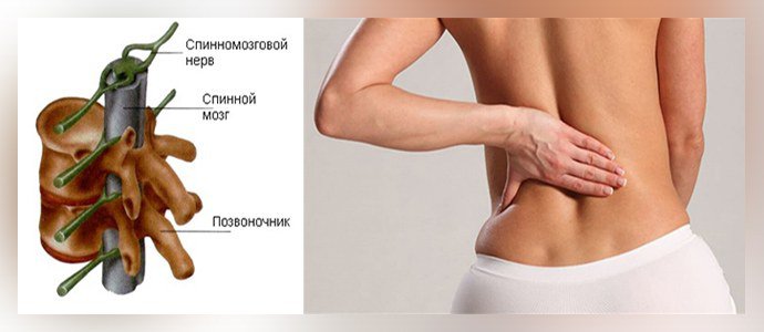 Эхинококкоз спинного мозга
